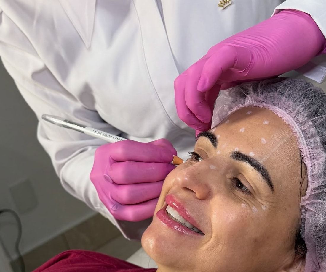 Mãos de luvas rosa marcando com lápis pontos brancos no rosto de uma paciente de touca, que sorri.
